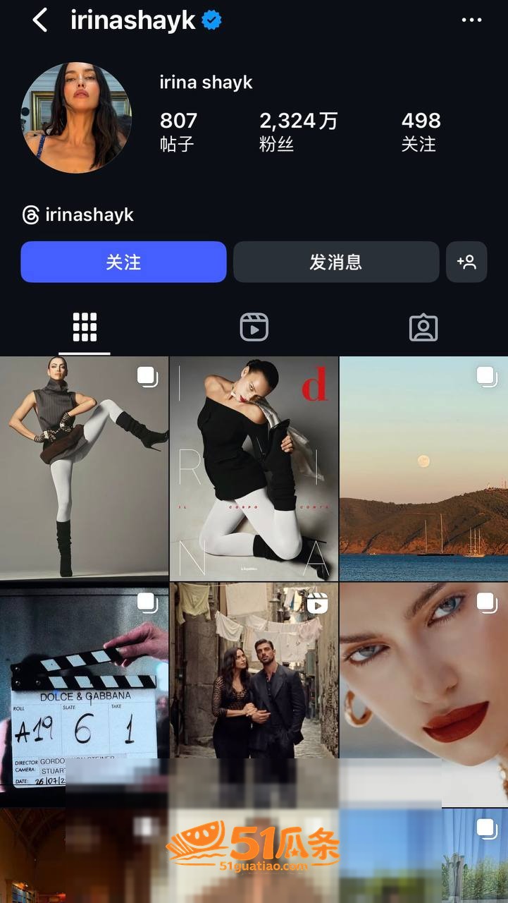 超模吃瓜 伊琳娜 恋相关图片16